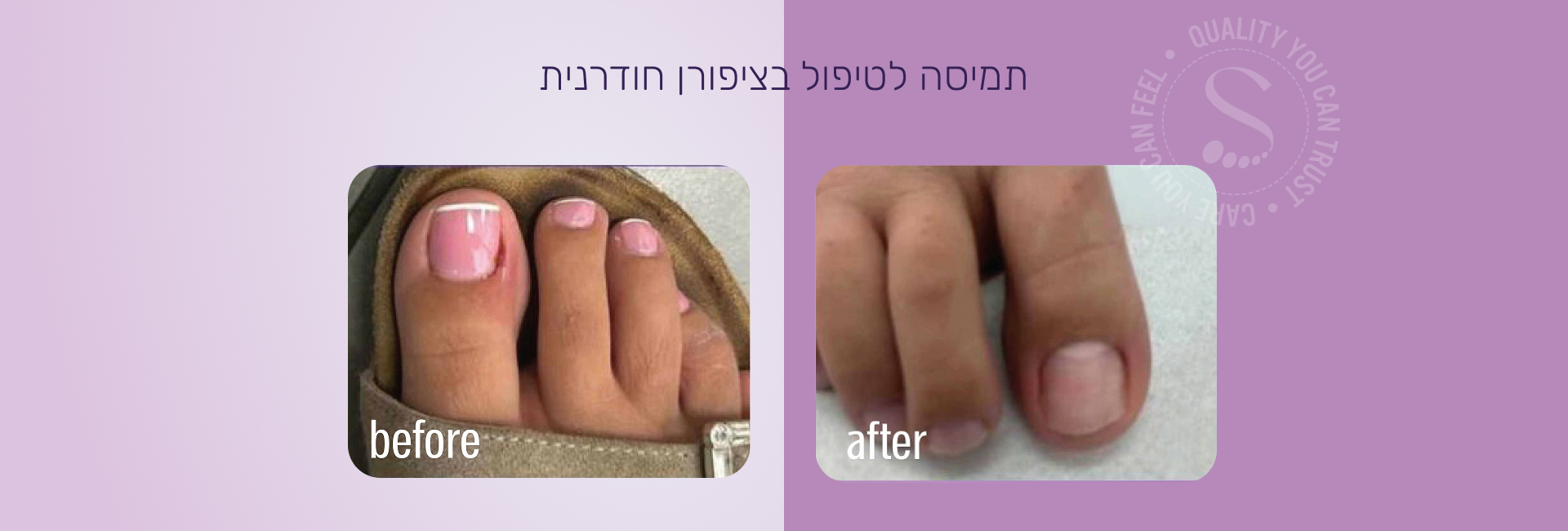 תמונה ללא תיאור